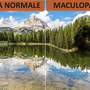 Lotta alle maculopatie, venerdì 14 maggio ad Aosta esami gratuiti