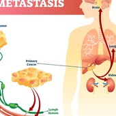 Ad Aosta la prima 'Panchina per la vita' contro il tumore metastatico