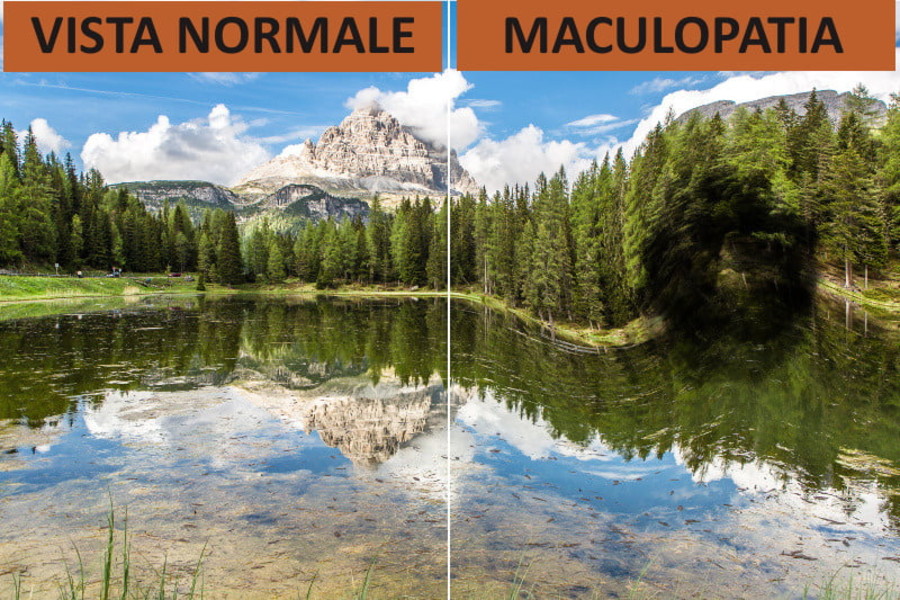 Lotta alle maculopatie, venerdì 14 maggio ad Aosta esami gratuiti